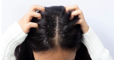 Natural recipes for treating dandruff.. the ingredients are available in your home