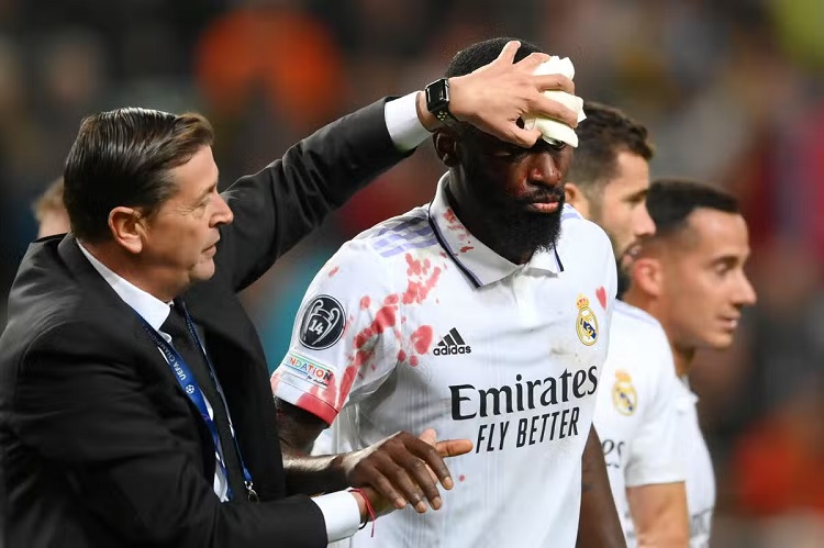 Real Madrid reassures Rudger’s injury and wears a face mask in El Clásico