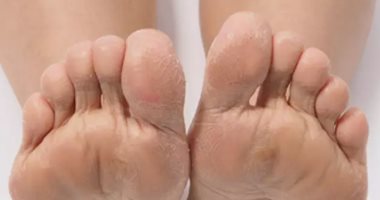 Do you suffer from foot cramps at night? .. Learn the causes of the situation