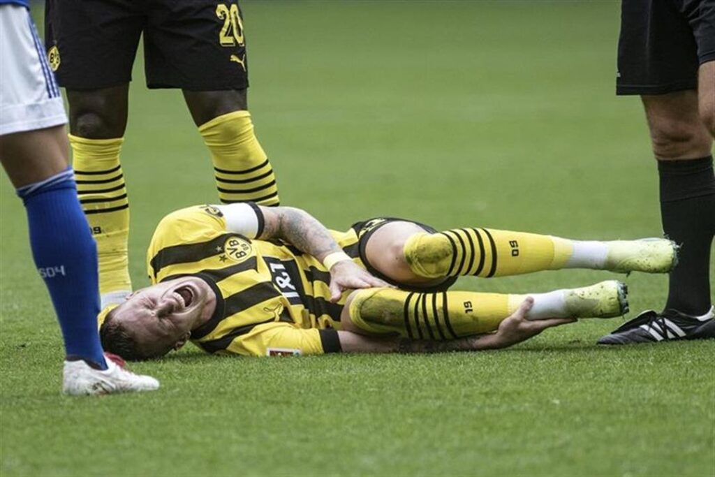 Dortmund coach raises doubts about Royce’s participation against Man City