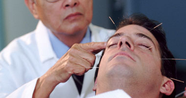 How acupuncture helps in treating and stiff neck pain