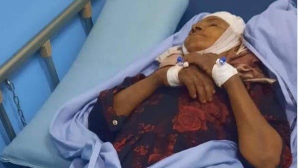 Houthi crimes are endless .. They broke an elderly rib and hit her daughter