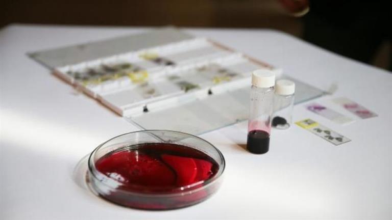 A scientific miracle .. The success of experiences on the first industrial blood in history