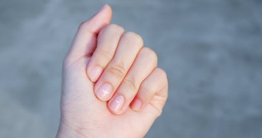 Take your mind .. the color of the nails indicates heart disease, thyroid and liver