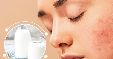 Tips to reduce acne infection, most notably eating certain foods and good sleep